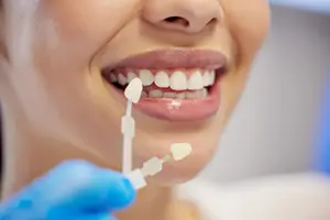 Hollywood Smile z porcelanowych licówek
